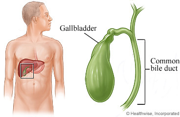 Kolangitis